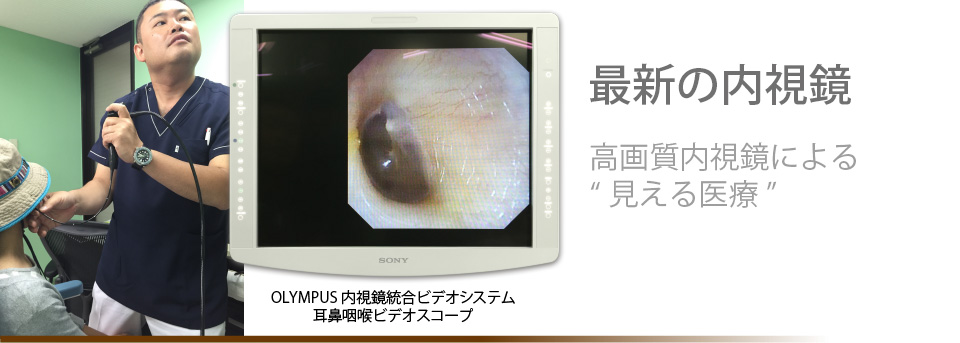 最新の内視鏡　高画質内視鏡による”見える医療”